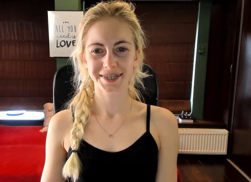 sexy girls with braces